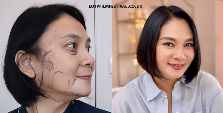 Dian Nitami Jalani Prosedur Facelift, Ini Respon Suaminya !!